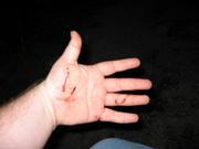 Oops.  I fell, and cut up my hand on the rocks.  Luckily, most of my weight fell on the lantern in my other hand.  